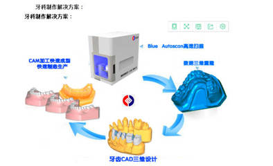 牙齿三维扫描仪 重塑口腔医疗与技术服务新体验
